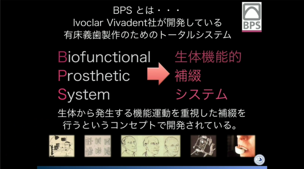 人気動画】BPSテクニックの考え方をベースとした総義歯臨床のポイント 